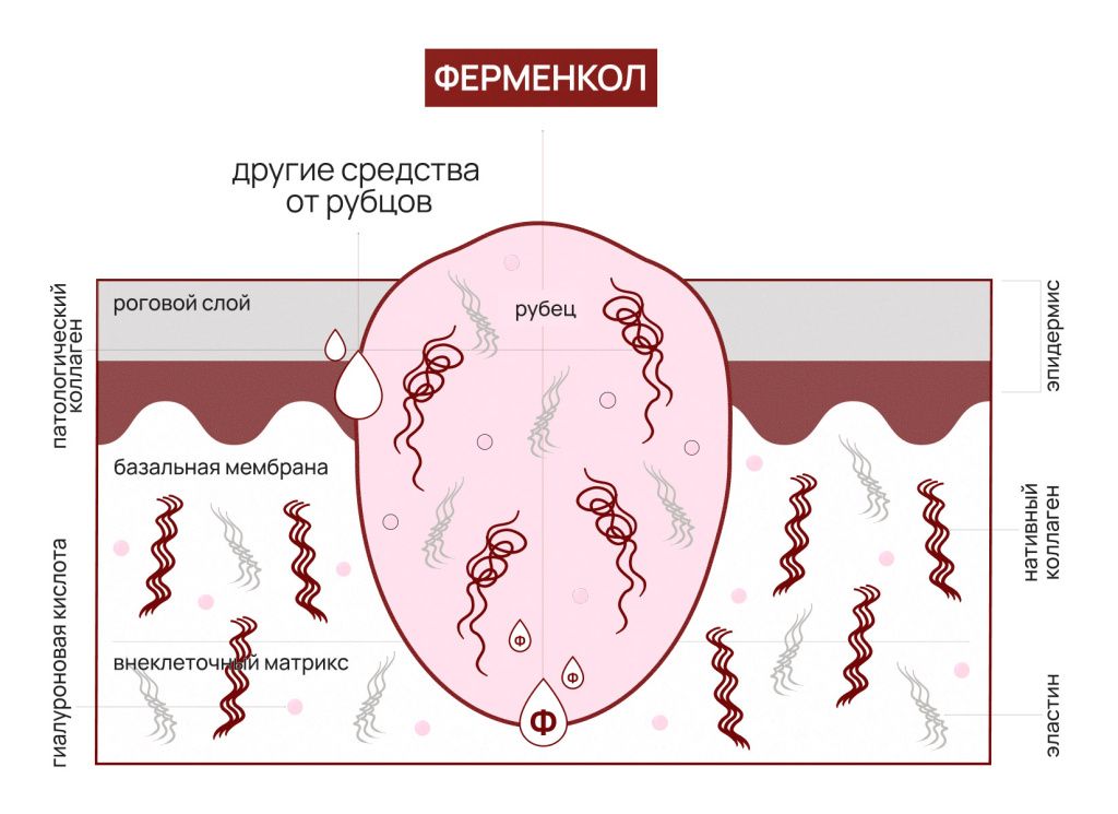 Как-действует-Ферменкол