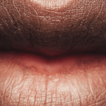 Уздечка губы и языка | «Стоматологическая поликлиника №19»